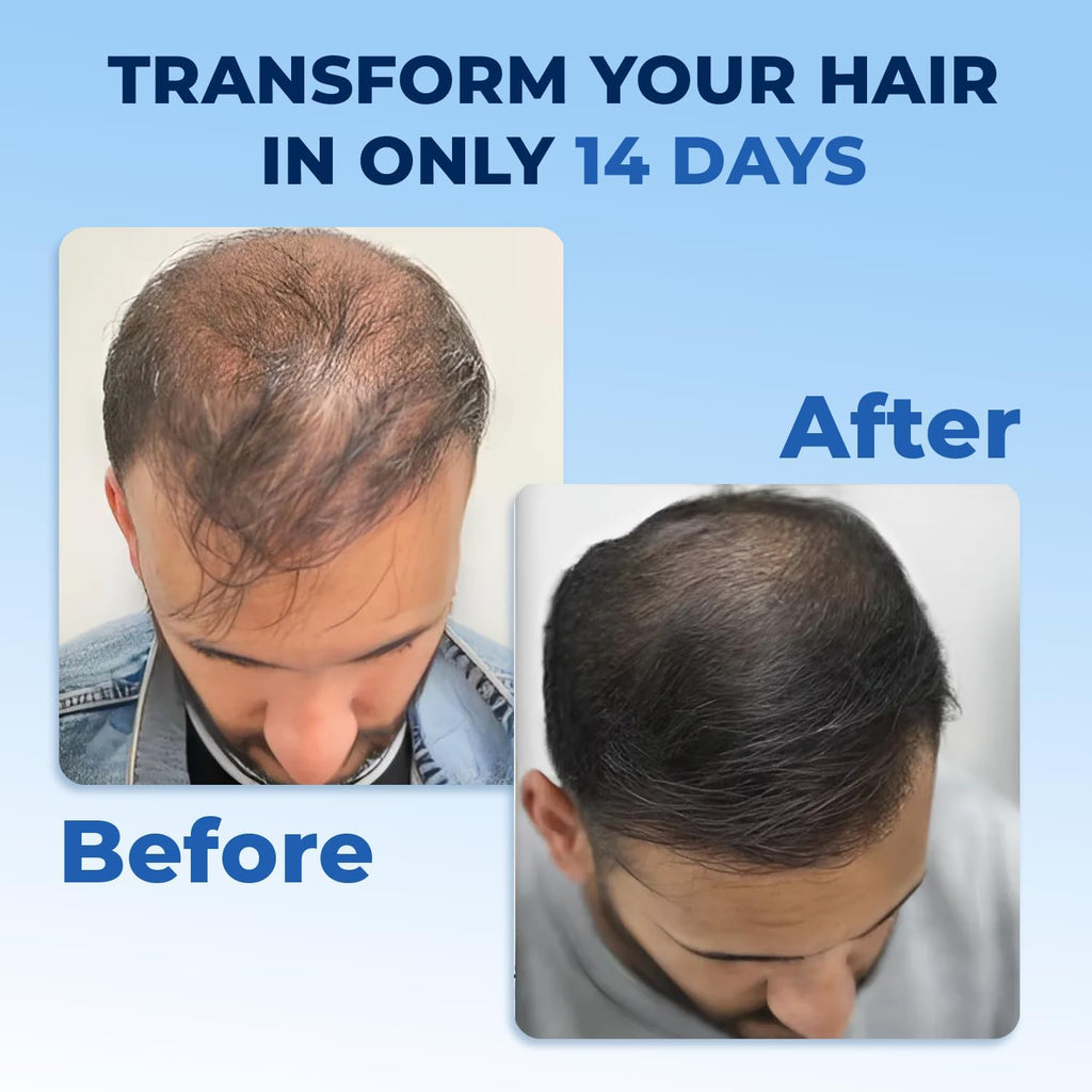 FEG Plus Hair Growth Spray